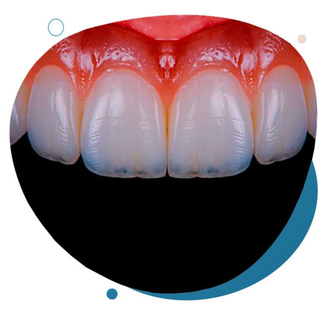 https://clinicadentalelpilar.es/wp-content/uploads/2024/07/estetica-clinica-dental-elpilar-640x605.jpg